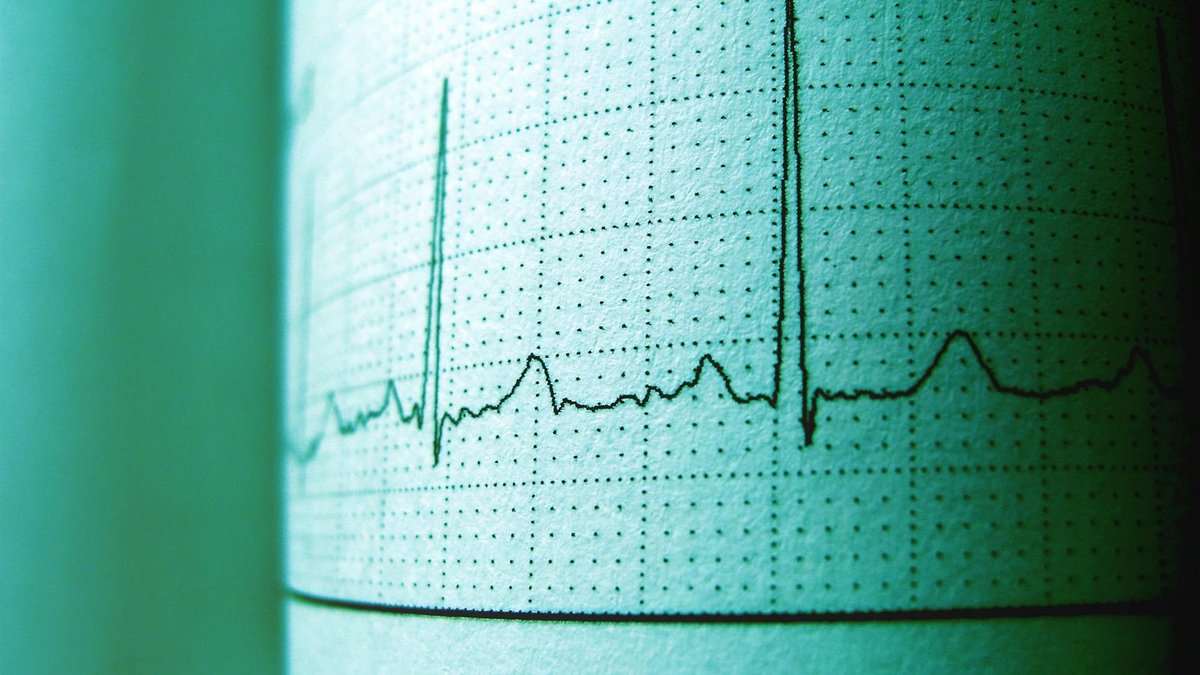 Crypto Market Pulse Haziran 1: BTC -2. 88, Volume Doubles